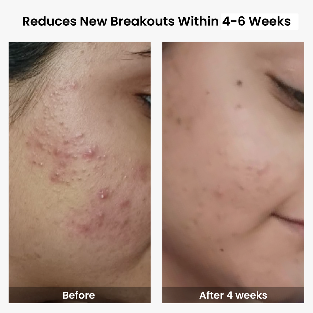 Customer Results